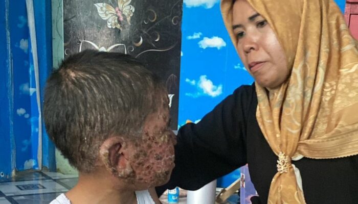 Zihad Sukabumi dan Candidiasis: Harapan Kecil di Tengah Derita Besar